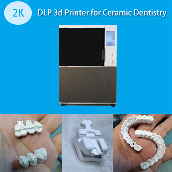 Чаму выкарыстоўваць 3D зубныя модэлі?