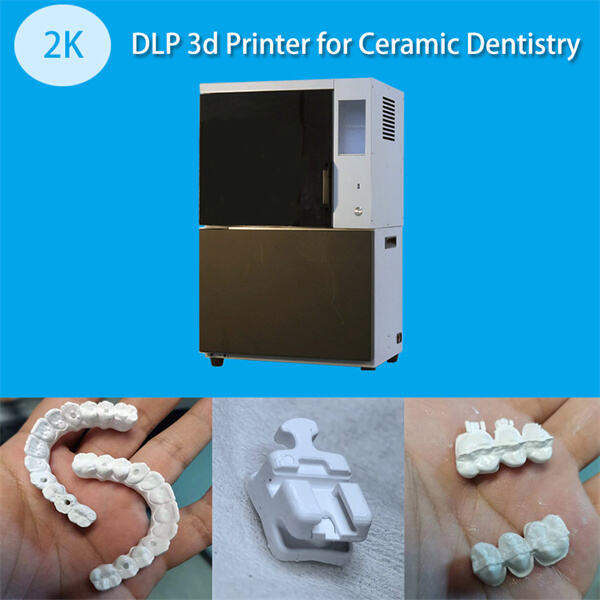 Падвышэнне якасці стоматалагічных имплантатаў з дапамогай 3D-друкаваных прастикіў